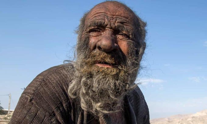 Man who hasn’t bathed in more than 60 years dies