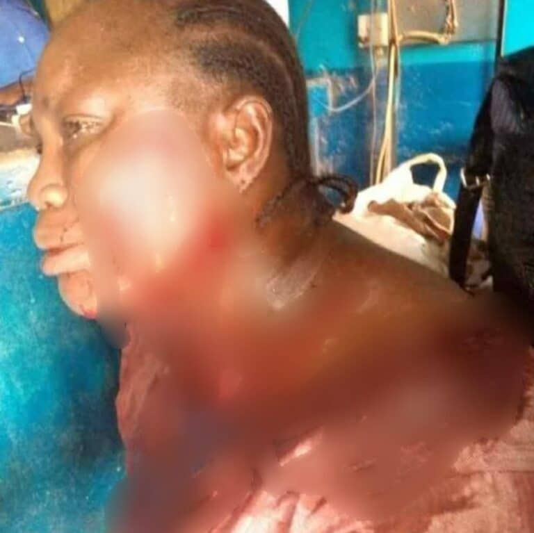 APC Women Leader stabbed by her neighbor in Osun