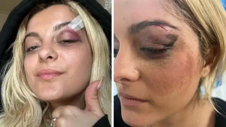 Singer Bebe Rexha rushed off stage over mid-concert attack