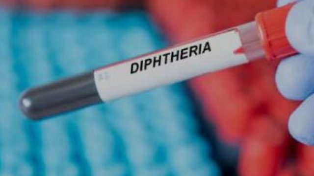 Diptheria: Kano gov’t announces additional treatment centres as 40 die from fresh outbreak